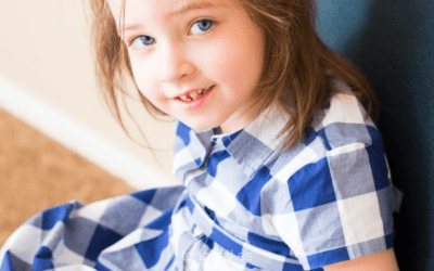 Em padecía una displasia de cadera