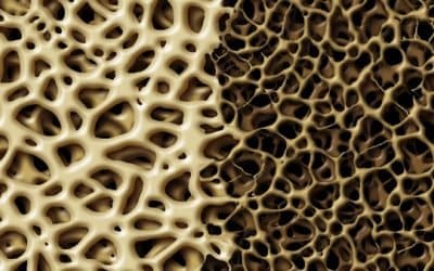 Mejora la osteoporosis